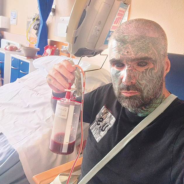 Rizika inkoustu na vlastním těle: nejpotetovanější Brit nečekaně oslepl